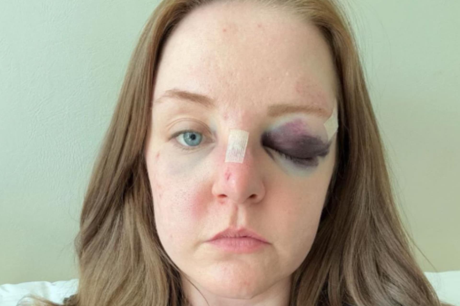 https://images.dailyhive.com/20250520155220/Seawall-attack.jpg